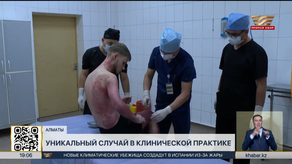 Алматинские врачи спасли пациента с ожогами 89% тела после взрыва
