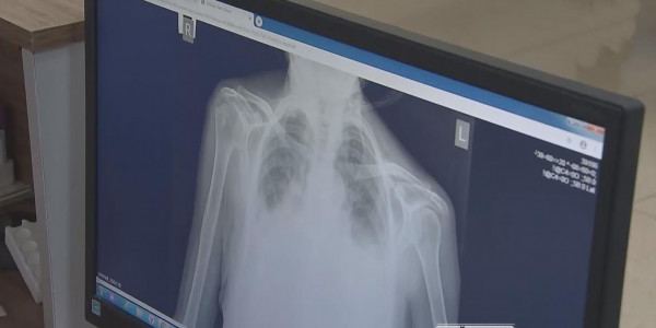 24 наурыз &ndash; Дүниежүзілік туберкулезге қарсы күрес күні