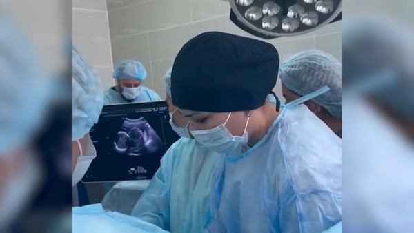 В Казахстане впервые провели фетальную операцию