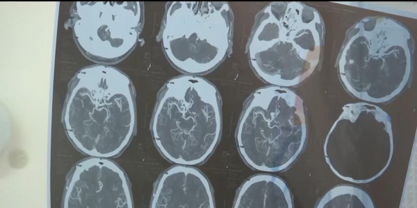 Қарағандыда жансақтау бөлімінде жатқан бала есін жиды