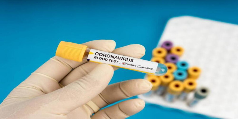 Koronavirus statistikasy 