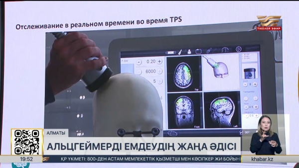 Енді елімізде альцгеймер ауруын жаңа әдіспен емдеуге болады