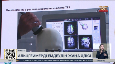 Енді елімізде альцгеймер ауруын жаңа әдіспен емдеуге болады