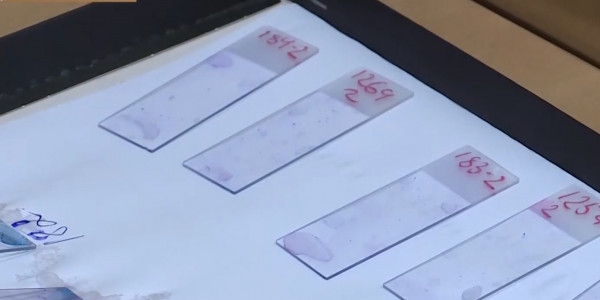 300 актюбинских семей стоят в очереди на ЭКО по квоте