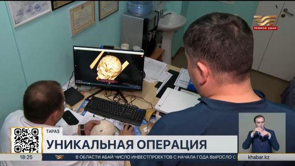 Уникальную операцию ребенку с врожденной деформацией черепа провели в Таразе