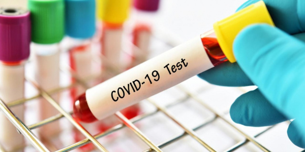 В Казахстане скончалась женщина от коронавируса