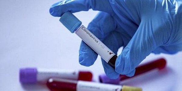 АНТИРЕКОРД: елімізде бір тәулікте 7 778 адамнан СOVID-19 анықталды