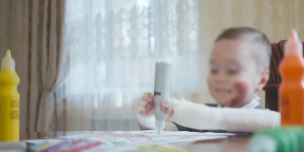 Больше 80 казахстанских детей с буллёзным эпидермолизом остаются без лекарств