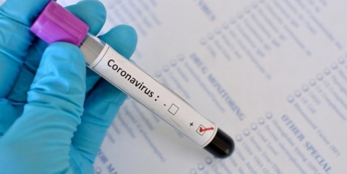 Число заболевших коронавирусом в Казахстане увеличилось