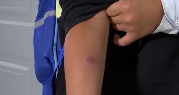 В Актау школьникам ошибочно ввели вакцину БЦЖ