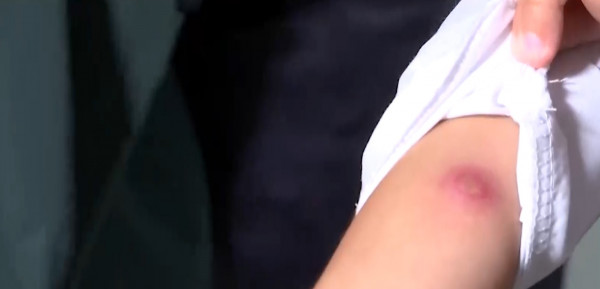 БЦЖ вместо Манту: начато расследование по факту ошибочной вакцинации школьников