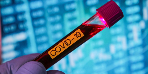 Зарегистрировано еще 3 случая заражения коронавирусной инфекцией в г. Нур-Султан