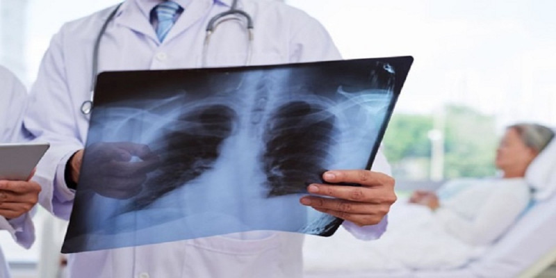 Девять врачей скончались от пневмонии в Шымкенте
