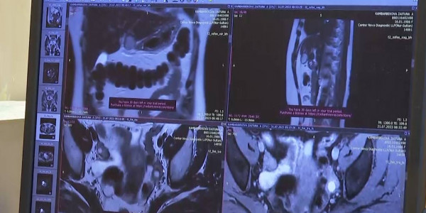 Ежегодно в Казахстане выявляют до 40 тыс. новых случаев онкологии